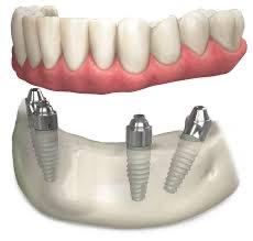 Dental Care