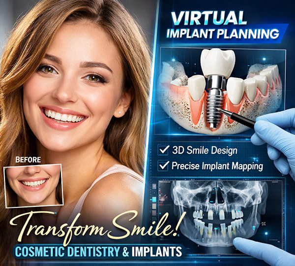implant3